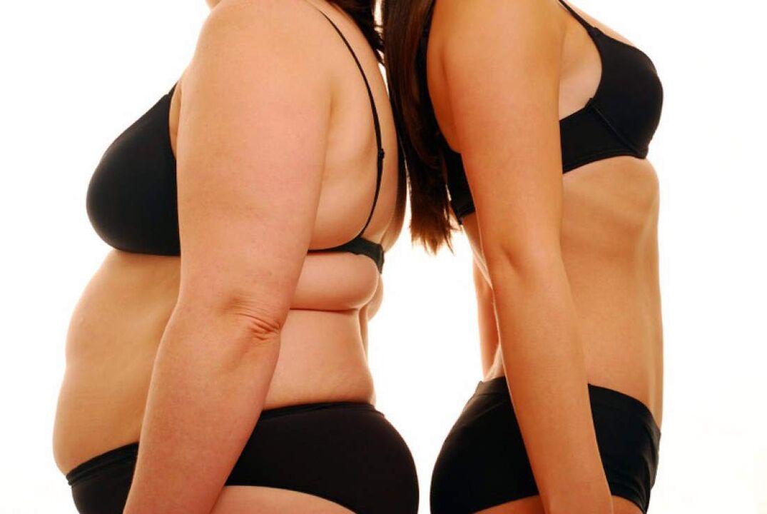 avant et après la perte de poids